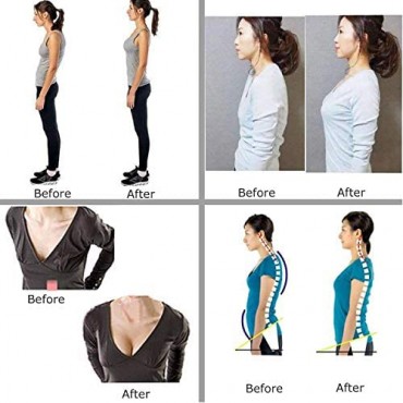 SLIMBELLE Women Sleeveless Posture Corrector Bra Chest Support Vest Back Brace Compression Shaper